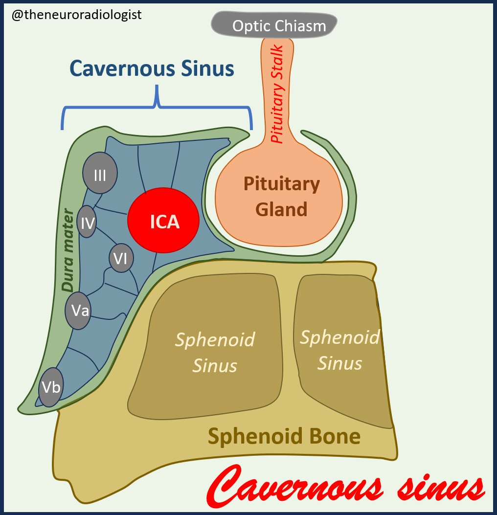 Cavernous Sinus Anatomy - still working on that presentation on pituitary anatomy, this time a drawing of the pituitary in the coronal plane with emphasis on cavernous sinus anatomy, not my best one, but still working on it. #MedEd #FOAMed #neurorad #anatomy #Medical