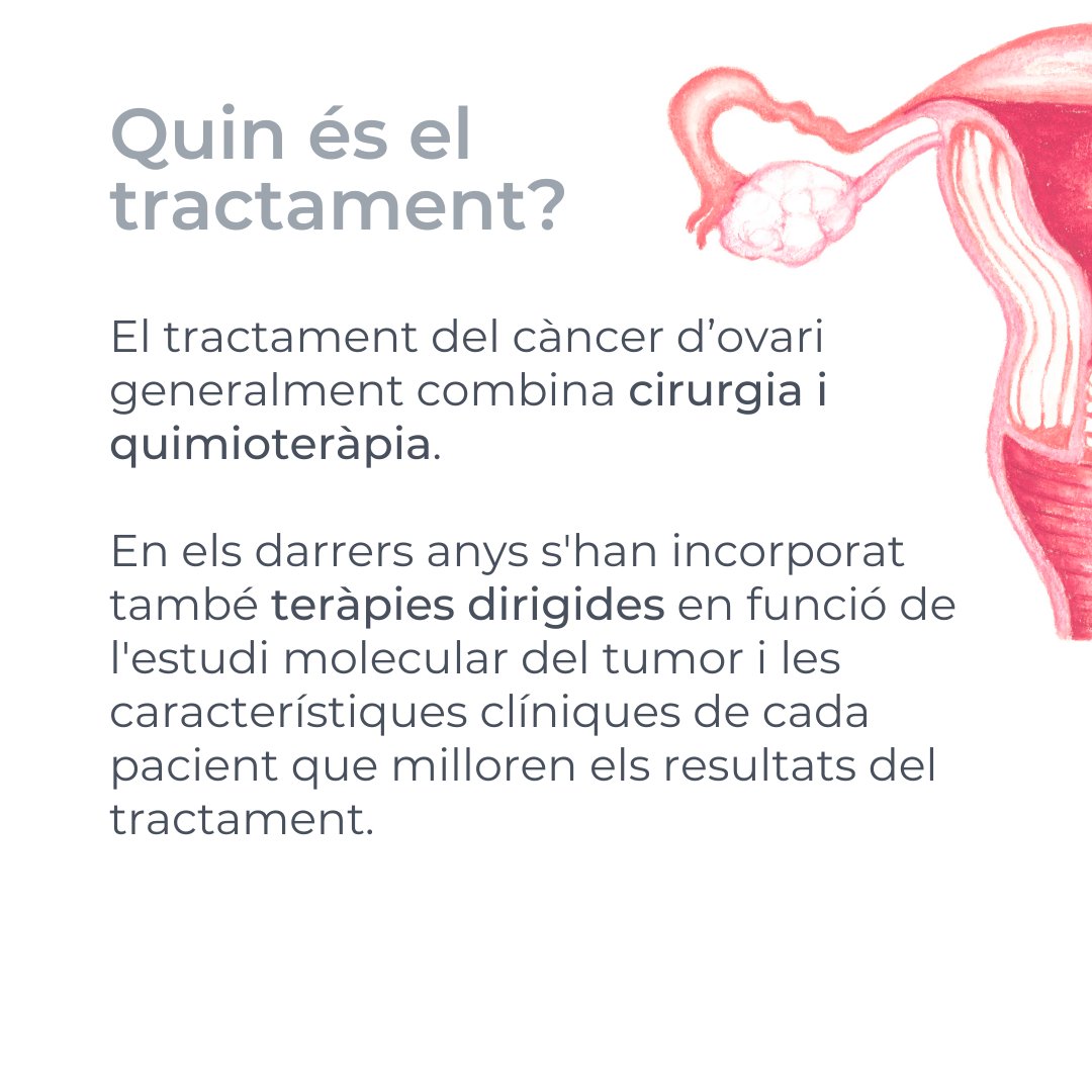 ICO_oncologia's tweet photo. El #càncer d'#ovari és poc freqüent. 
Acostuma a causar símptomes poc específics i això fa que s'endarrereixi el diagnòstic i la malaltia estigui avançada quan es detecta.
Les teràpies dirigides n'estan millorant el tractament i la supervivència.
#DiaMundialCàncerOvari https://t.co/aBow0C5ab5