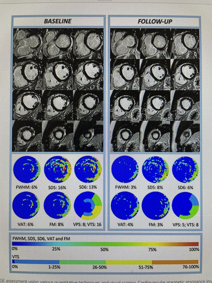 Robert Manka (@rmanka_) on Twitter photo ๐ฅ Happy to share our latest work by Mihaly Karolyi on ๐งฒ CMR in Myocarditis Follow-up imaging . โก๏ธ How to quantify fibrotic changes over time. <a href="/j_sokolska/">Justyna Sokolska</a> <a href="/Alkadhi_rad/">Alkadhi</a> <a href="/MKolossvary/">Mรกrton Kolossvรกry</a> <a href="/ShehabAnwer/">Shehab Anwer, MD</a> <a href="/CardioZurich/">Cardiology USZ</a> <a href="/RadiologieUSZ/">Radiologie USZ</a> <a href="/EurRadiology/">European Radiology</a>
LINK: โก๏ธ rdcu.be/dHhG6 ๐ฅ Happy to share our latest work by Mihaly Karolyi on ๐งฒ CMR in Myocarditis Follow-up imaging . โก๏ธ How to quantify fibrotic changes over time. <a href="/j_sokolska/">Justyna Sokolska</a> <a href="/Alkadhi_rad/">Alkadhi</a> <a href="/MKolossvary/">Mรกrton Kolossvรกry</a> <a href="/ShehabAnwer/">Shehab Anwer, MD</a> <a href="/CardioZurich/">Cardiology USZ</a> <a href="/RadiologieUSZ/">Radiologie USZ</a> <a href="/EurRadiology/">European Radiology</a>
LINK: โก๏ธ rdcu.be/dHhG6
