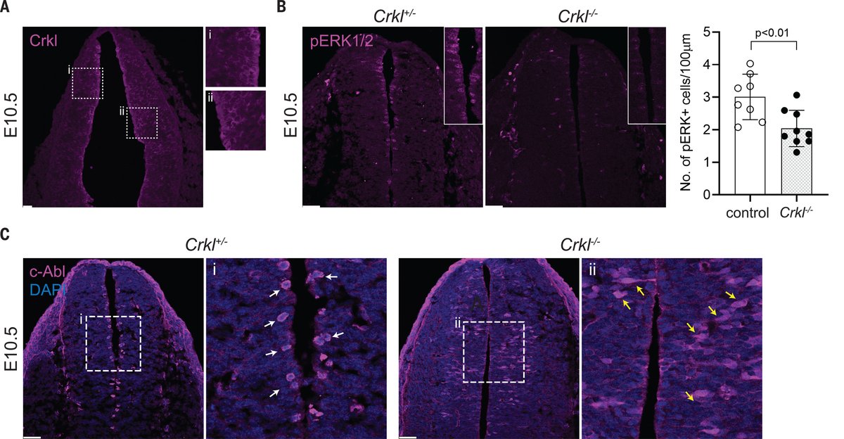 Chromosomal 22q11.2 deletions increase risk for meningomyelocele, one of the most severe and common forms of spina bifida, a new Science study finds.

📄: scim.ag/6Sz