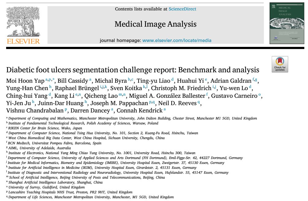 International research collaboration - identifying diabetic foot ulcers with AI - new paper: pubmed.ncbi.nlm.nih.gov/38569380/ @moihoonyap @MMU_Research @McrInstSport