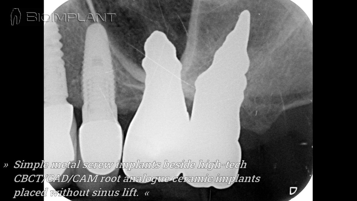 BioImplant (@bioimplant) on Twitter photo 