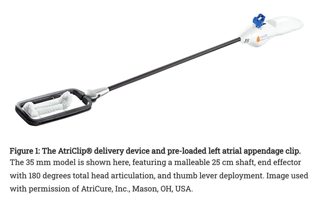 Exciting new research from our @khalpeylab! Skipping anticoagulation for postop atrial fibrillation is safe when the left atrial appendage is ligated during CABG. 

Reduces bleeding risk while still protecting against stroke. 🫀💉 

Key findings: 
✅ No stroke/TIA in POAF