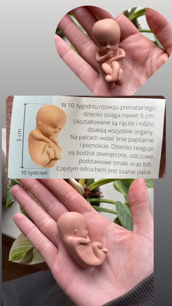 10 tydzień ciąży. W Polsce nierząd chce wprowadzić barbarzyńskie prawo zabijania ludzi do 12 tygodnia. Zobaczcie na tego CZŁOWIEKA, czemu ten bezbronny maluszek nie ma prawa żyć? On nie może się sam obronić. Tzw aborcja to zabicie człowieka-zawsze. @ProLifeBMS #prowoman #prolife