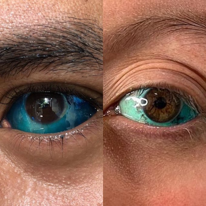 what color do u think wud suit me more? ocean blue or turquoise stone&hellip;. these are by gato btw https://t