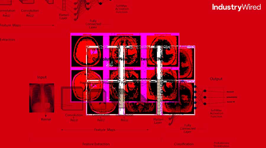 How CNNs Are Powering Breakthroughs in Medical Imaging

shorturl.at/avMW2
 
#CNNsinmedicalimaging #DeeplearninginNeuralNetworks #Medicalimage #AIinradiology #IW #IWNews #IndustryWired