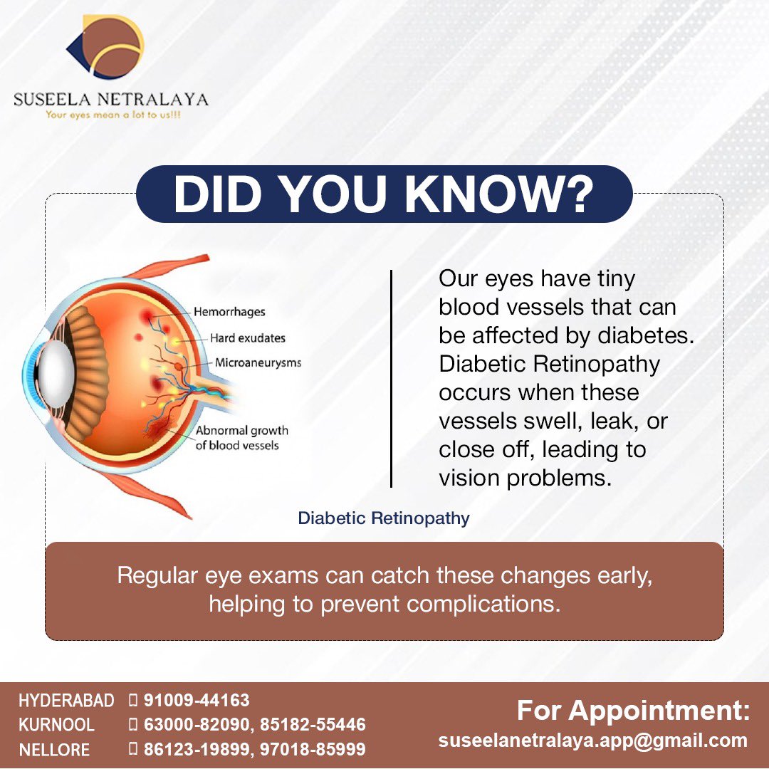 Did you know?

 #EyeHospital #RetinaCare #heathyeyes #OculoplastySurgery #doctor #NoMoreGlasses #eyecareforall #ClearVision #EyeConfidence #DiabetesAwareness #eyesight #Hypertension #contactlens #eyecaretips #CataractAwareness #BrighterOutlook #SuseelaNetralaya #VisionProtection