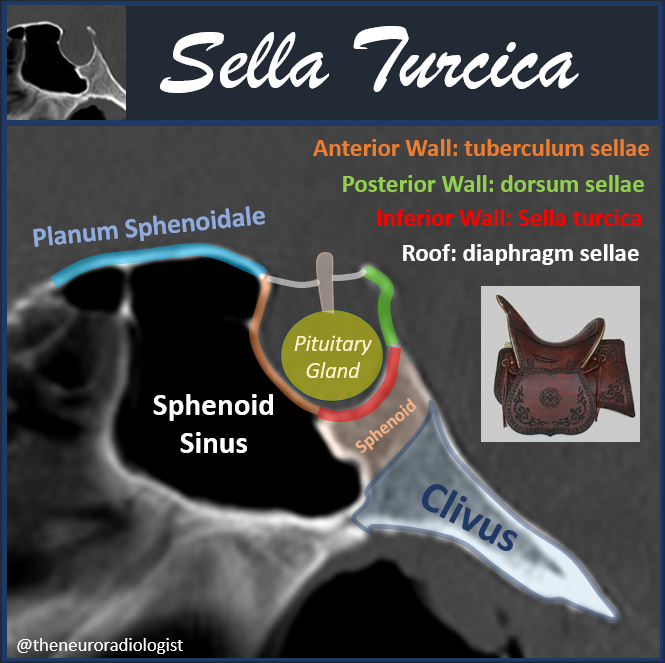 Do you know why they call it the 'sella turica'? Although technically speaking the term 'sella turcica' refers to the floor of the pituitary fossa, it is often used as a synonym for the pituitary fossa. #RadEd #FOAMed #neurorad