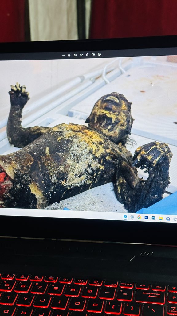 ⚠️Sensitive Content ⚠️

Journalist @HossamShabat captured a harrowing image of a child from #Gaza burned by Israeli missiles, seemingly screaming in agony

Never thought I'd share such a harrowing picture, but the atrocities of the Israeli army must be exposed to the whole world!