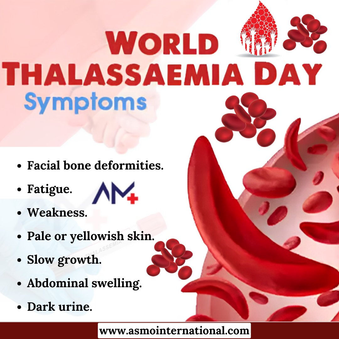 Symptoms of Thalassemia
.
bit.ly/3nHERKo
.
#WorldThalassemiaDay #ThalassemiaAwareness #BloodDisorder #IronDeficiency #GeneticDisease #RedBloodCellDisorder #HealthyBlood #healthcare #asmointernational #asmohealth #asmomedicines #asmocare #asmoresearch #asmo