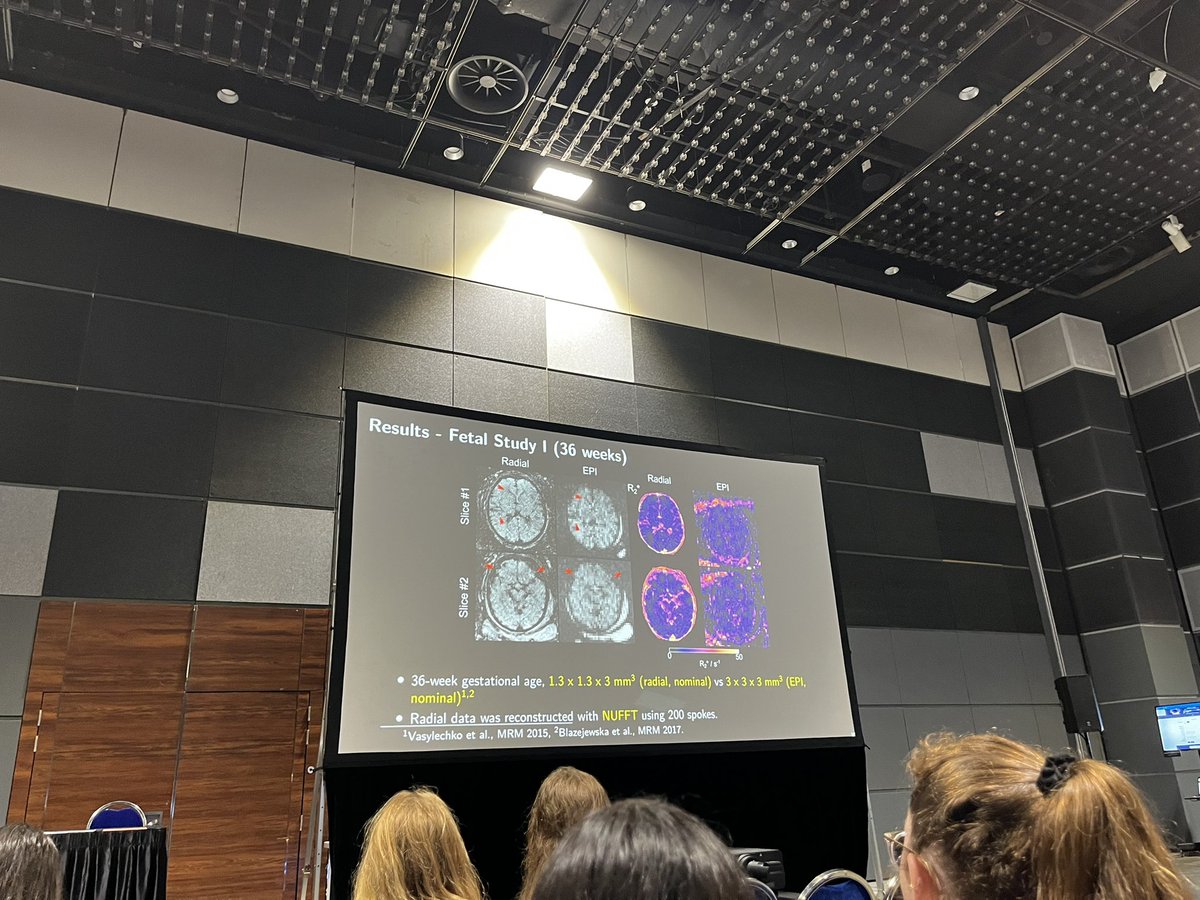 Peak into the future of #fetalimaging at #ISMRM24! @KingsImaging @boschildrensrad Also check out our recent review of #fetalmri techniques! Thanks @Camilojaimesc and John Choi for the invitation mri.theclinics.com/article/S1064-…