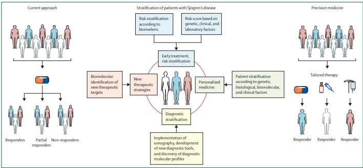 NEW REVIEW—Saviana Gandolfo and colleagues discuss how stratification in Sjögren's disease might guide precision medicine and inform the design of future clinical trials thelancet.com/journals/lanrh…