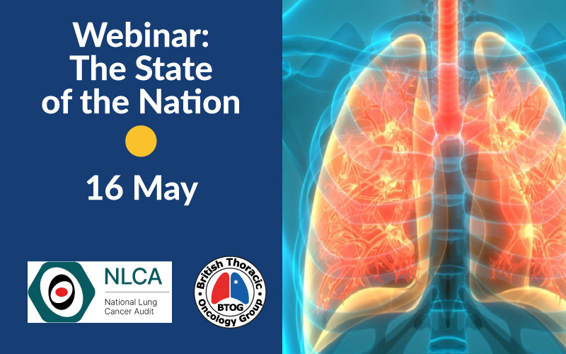 Next #BTOGwebinar is with the <a href="/NLCA_uk/">National Lung Cancer Audit</a> to discuss the State of the Nation Report 2024, chaired by <a href="/Doctor_Neal/">Neal Navani</a>.

Thu 16 May - 17.30

btog.org/reviewing-the-…

#BTOGNLCAwebinar