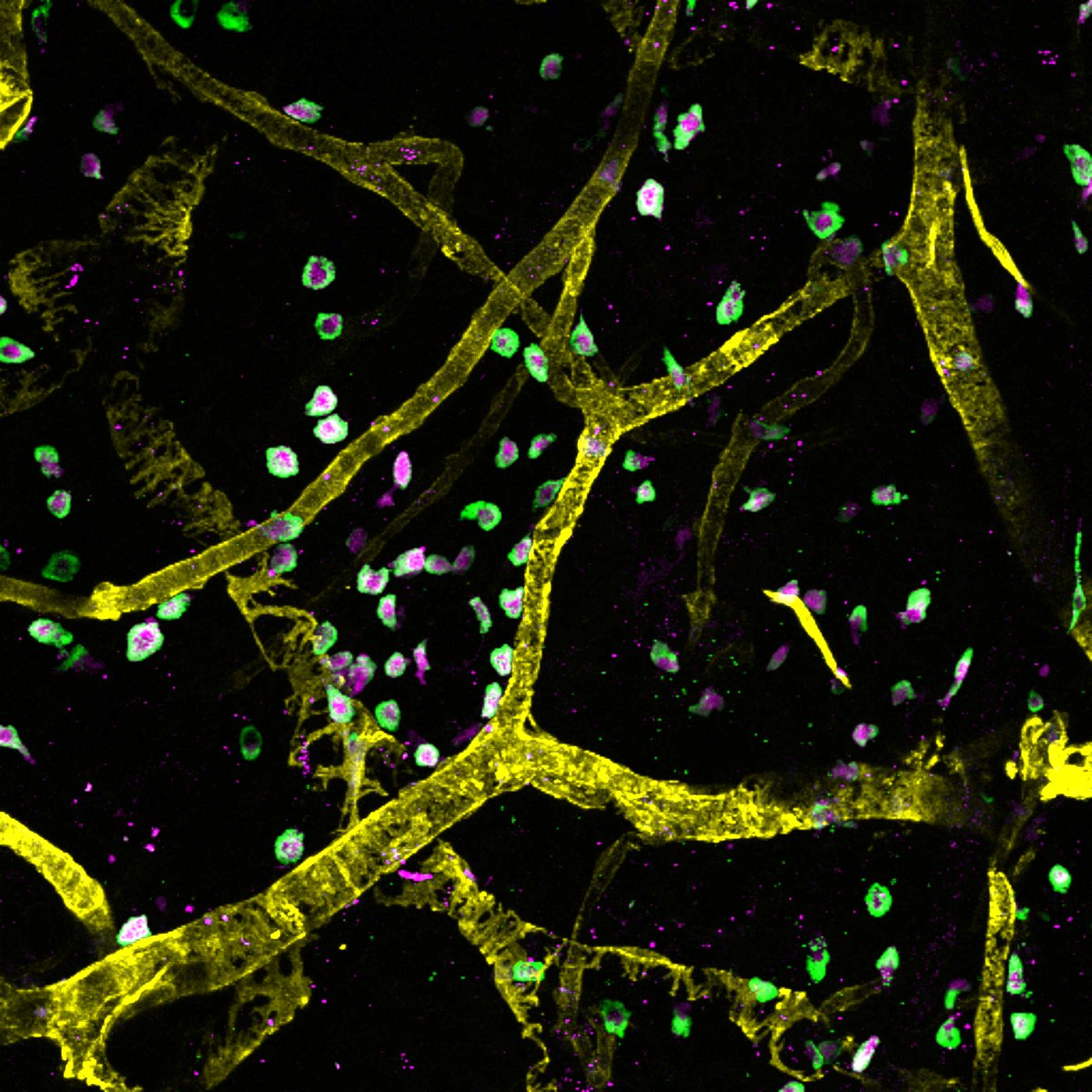 New #fluorescentfriday with this week, a picture of first year PhD student Ciara analysing French 🇫🇷 & Scottish🏴󠁧󠁢󠁳󠁣󠁴󠁿RMB mice for #mastcells (green/purple) and blood vessels (aSMA, yellow) in the ear. 

@GentekRebecca @lloyd_lab @ImarisSoftware @ImperialNHLI