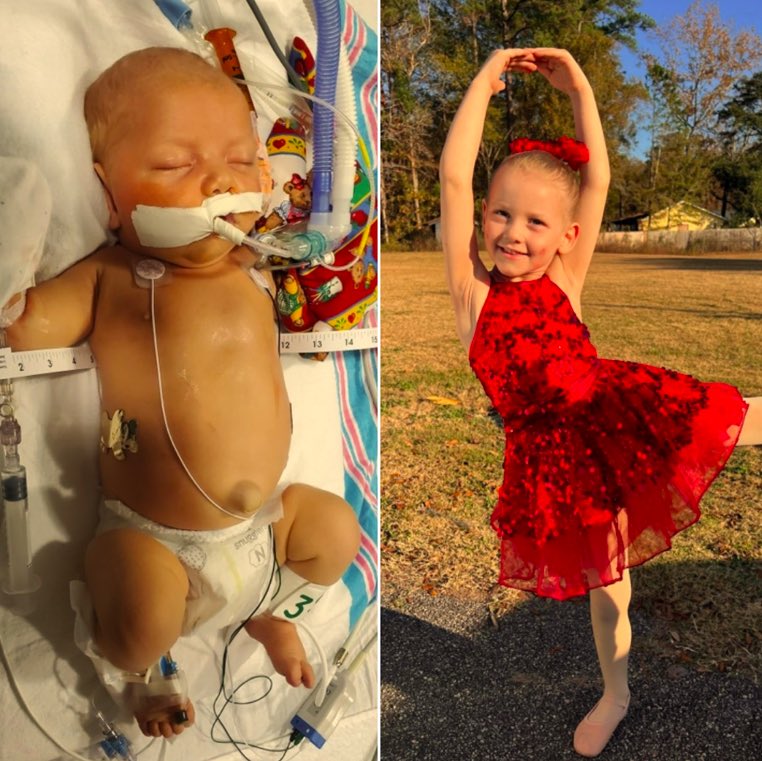 Through the Love of RMHC Charleston and MUSC Kids, Eleanor is a shining 5 year old with a future as bright as the sun - Learn about Eleanor's remarkable story - Charleston Daily - bit.ly/3JS2Ovq #CharlestonDaily #CharlestonSC @MUSChealth @MUSCkids @RMHCCharleston