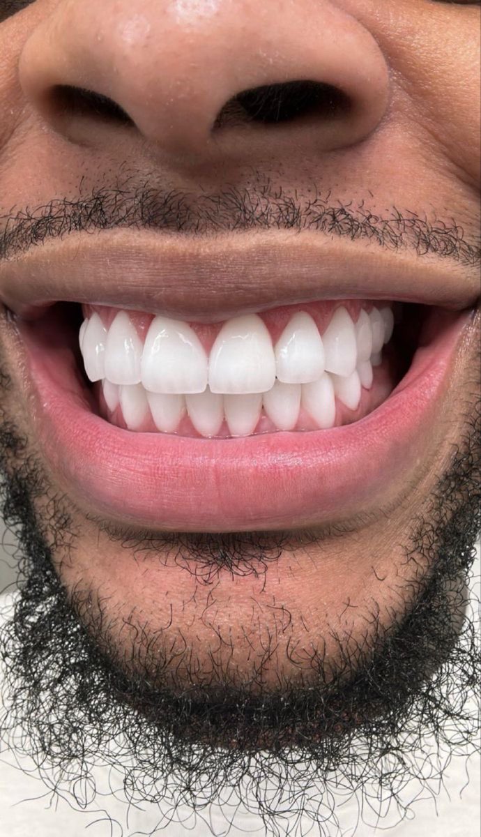 Show us your teeth if you’re proud of yourself 

I’ll go first😁