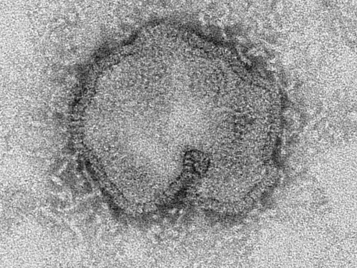 #grippe Un virus grippal chez des bovins. Une nouveauté insolite aux conséquences imprévisibles

jhmcohen.com/2024/05/08/les…