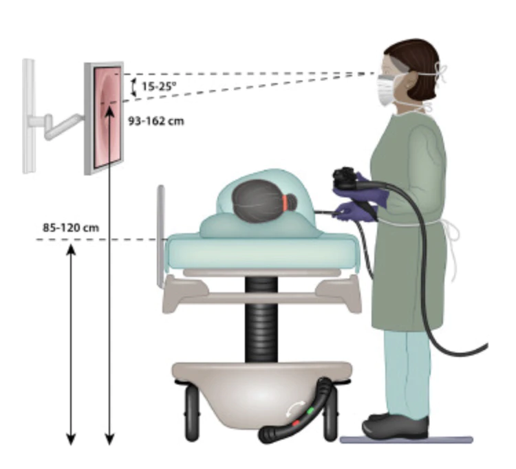 Ergonomics in the Endoscopy Suite

It is very important for endoscopists and staff to keep a comfortable body posture during endoscopy to prevent musculoskeletal strains and inflammation. Key aspects include having several monitors and sitting stools in the suite.