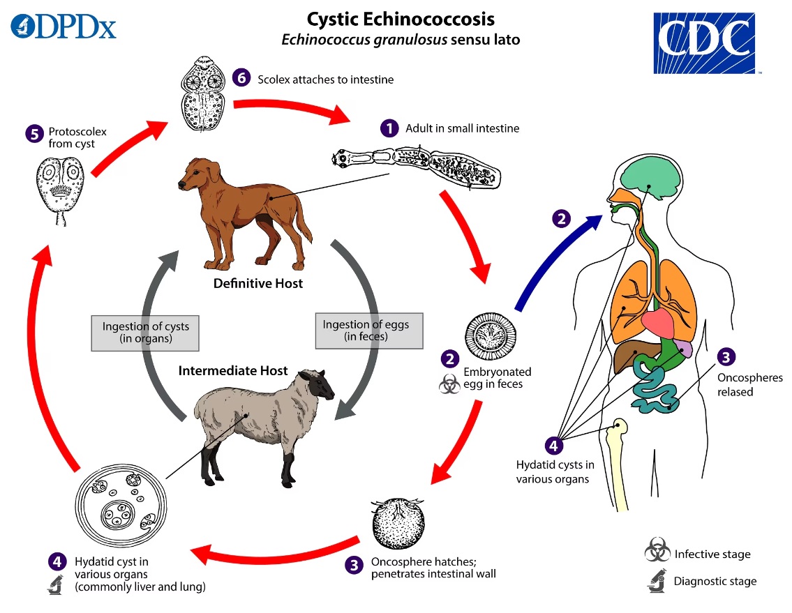 🪱 Echinococcus→tapeworm causes cystic dz Livestock int host w/ carnivore def host 🐑➡️🐕➡️💩➡️🖐️➡️👄 🫀Heart affected <2% ✅Severe dz can cause pulm emb, CAD, & anaphylaxis ✅Tx is usually surgical w/ albendazole pubmed.ncbi.nlm.nih.gov/10725298/ 5/6 @SCMRorg