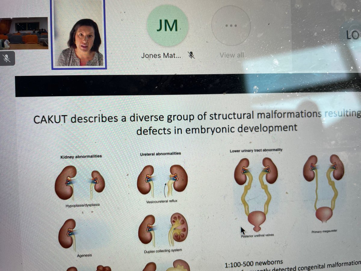 A pleasure to have the fantastic @drmelaniechan virtually join us @AlderHeyRes with our urology colleagues Her talk clearly showed the unmet need for children with CAKUT and her plans to transform the future @AlderHeySurgery