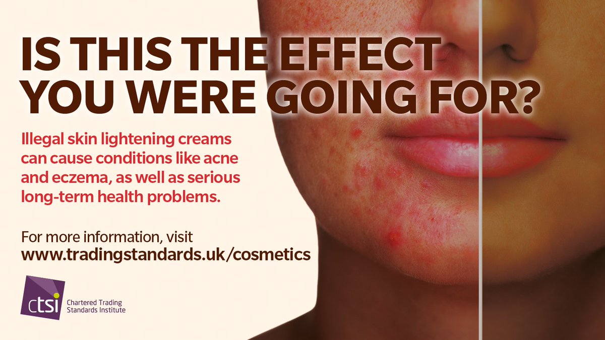 Illegal skin lightening creams can cause conditions like acne and eczema, as well as serious long term health problems. Know what you're buying! @CTSI #CostofBeauty