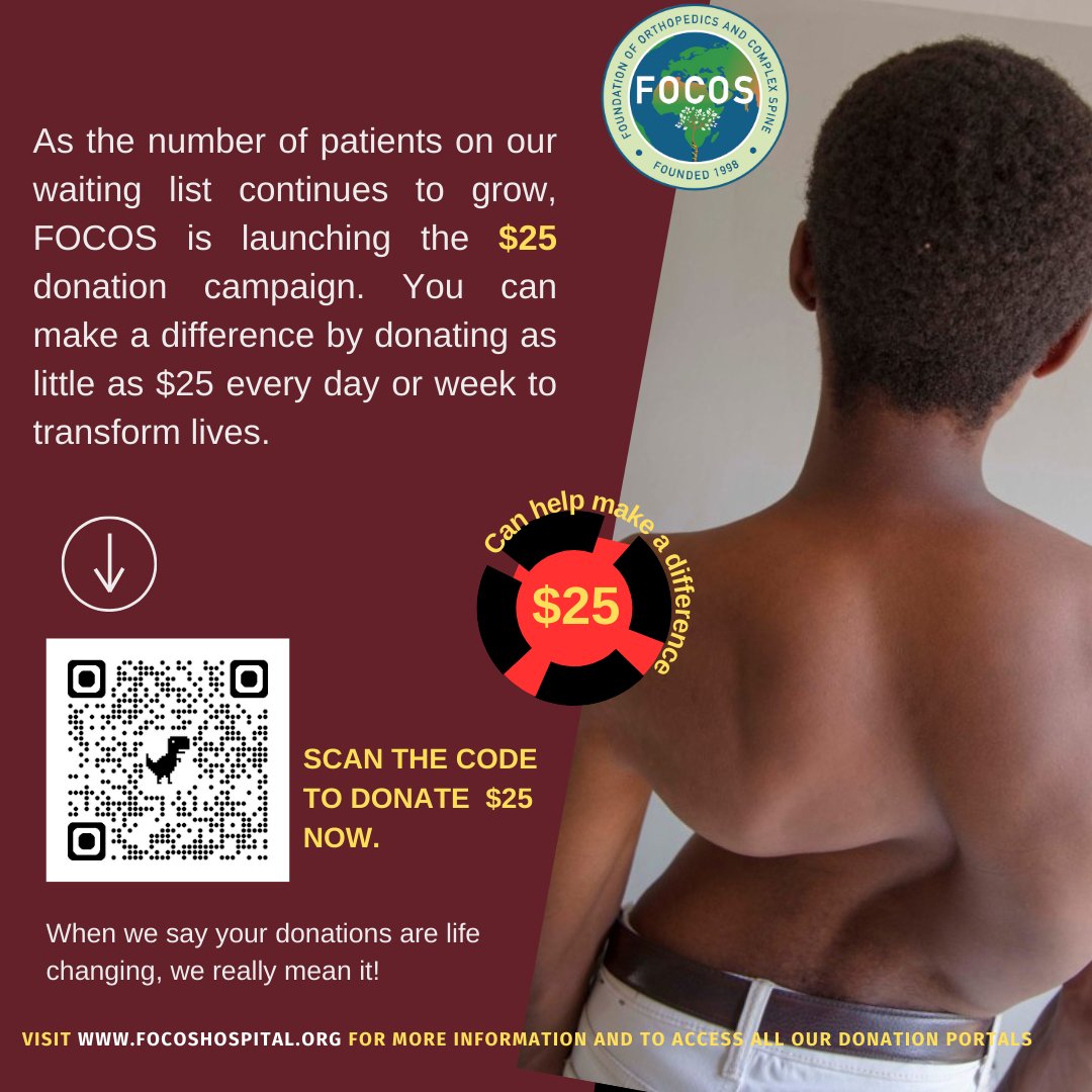 Transforming lives starts with just $25. Join our $25 donation campaign today and make a lasting impact on the lives of those in need. We need 500 people to donate as little as $25 to sponsor a patient. Every contribution counts! [Please help us spread the word]
#FOCOS #DonateNow
