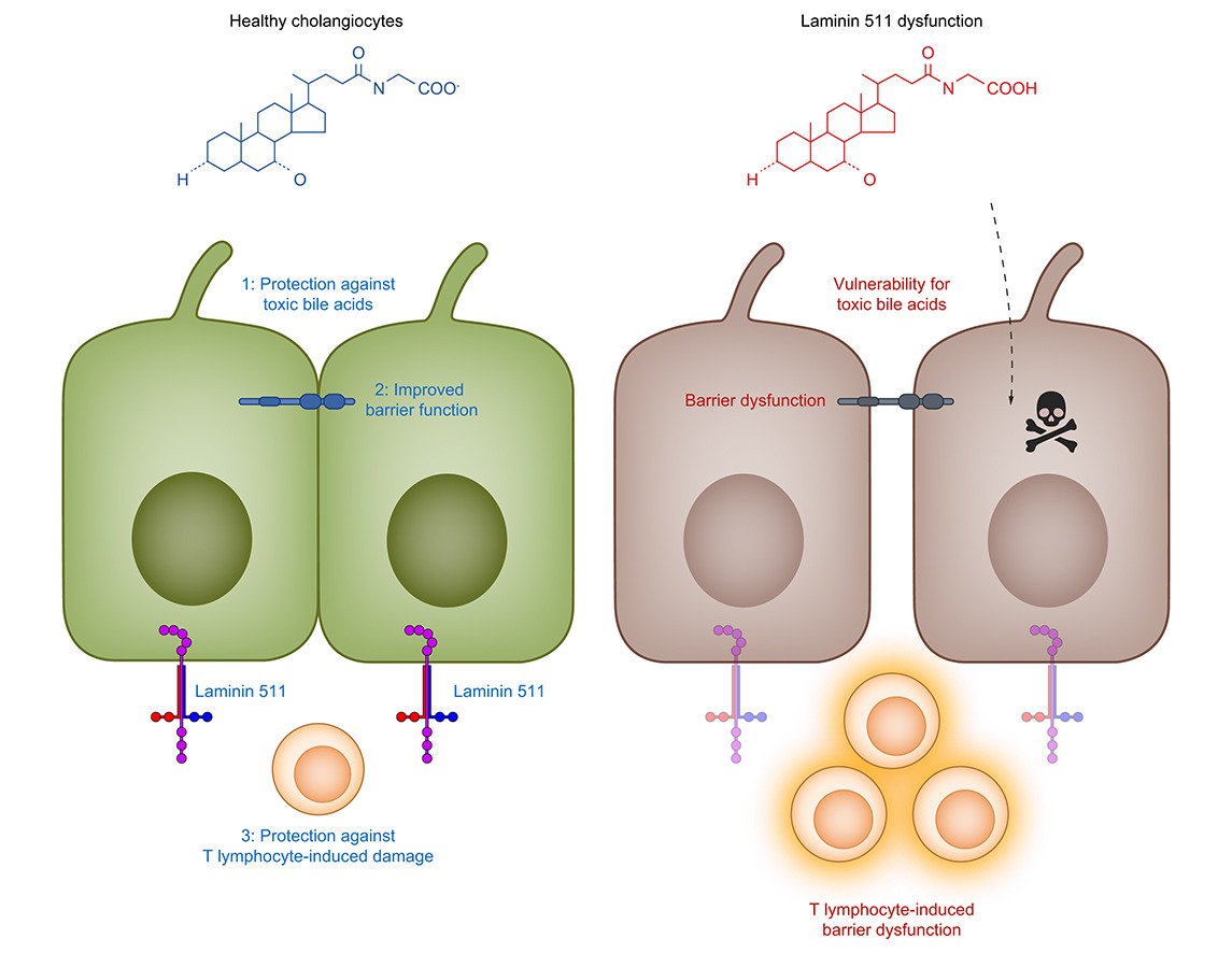 JHEP_Reports's tweet image. ❕Laminin 511-E8, an autoantigen in IgG4-related cholangitis, contributes to cholangiocyte protection

🔓#OpenAccess at 👉jhep-reports.eu/article/S2589-…

#LiverTwitter
#cholangitis