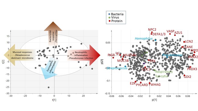 James D Chalmers (@profjdchalmers) on Twitter photo Excited to share our new paper in <a href="/ATSBlueEditor/">ATS Blue Journal</a> describing the detailed microbiology and immunology of bronchiectasis exacerbations
We show
- Viruses are a major cause (particularly rhinovirus)
- There are exacerbation subtypes (neutrophilic/eosinophilic)
atsjournals.org/doi/abs/10.116โฆ Excited to share our new paper in <a href="/ATSBlueEditor/">ATS Blue Journal</a> describing the detailed microbiology and immunology of bronchiectasis exacerbations
We show
- Viruses are a major cause (particularly rhinovirus)
- There are exacerbation subtypes (neutrophilic/eosinophilic)
atsjournals.org/doi/abs/10.116โฆ