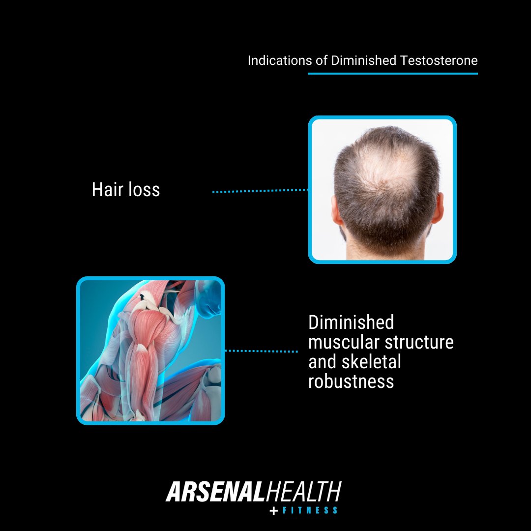 arsenalfit's tweet photo. Think you have low testosterone? Don't guess – get tested! ✅

Our bloodwork reveals the truth. Ditch fatigue, crank up your mood, and boost your energy levels.

Ready to find out what's holding you back? Book your bloodwork today. 🩸

https://t.co/r8oPYF6VQ4 https://t.co/55kRaKSBCr