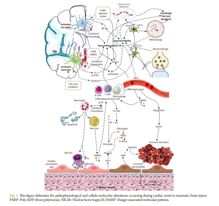 Paro Cardiaco en Lesión Cerebral Traumática 🫀🧠 🔰📚J Neurointensive Care 2024 doi.org/10.32587/jnic.… Enlace a Artículo Completo 👇🏽✅🆓t.me/SoMELaguna