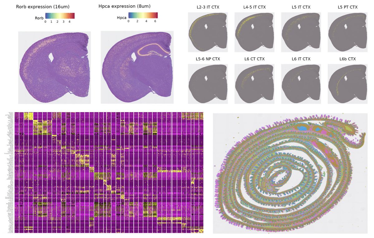 Excited to share our Seurat update supporting VisiumHD data from @10xGenomics. We explore and validate the ability of HD to map the spatial localization of individual cell types: satijalab.org/seurat/article…