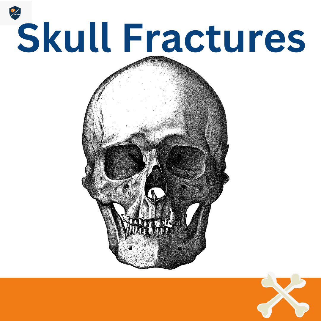 BrainPakistan's tweet photo. May is Skull Fracture Awareness Month, Protect Your Head, Protect Your Life. Wear protective gear, stay aware, and seek help if needed. Share to spread awareness! #SkullFractureAwareness #HeadSafetyMatters https://t.co/ZP8FsMHPK5