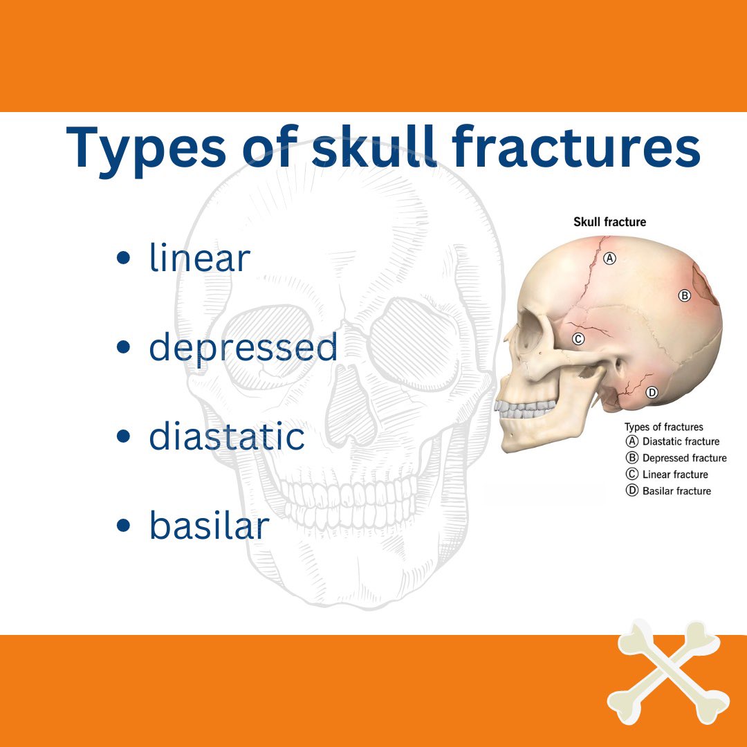 BrainPakistan's tweet photo. May is Skull Fracture Awareness Month, Protect Your Head, Protect Your Life. Wear protective gear, stay aware, and seek help if needed. Share to spread awareness! #SkullFractureAwareness #HeadSafetyMatters https://t.co/ZP8FsMHPK5