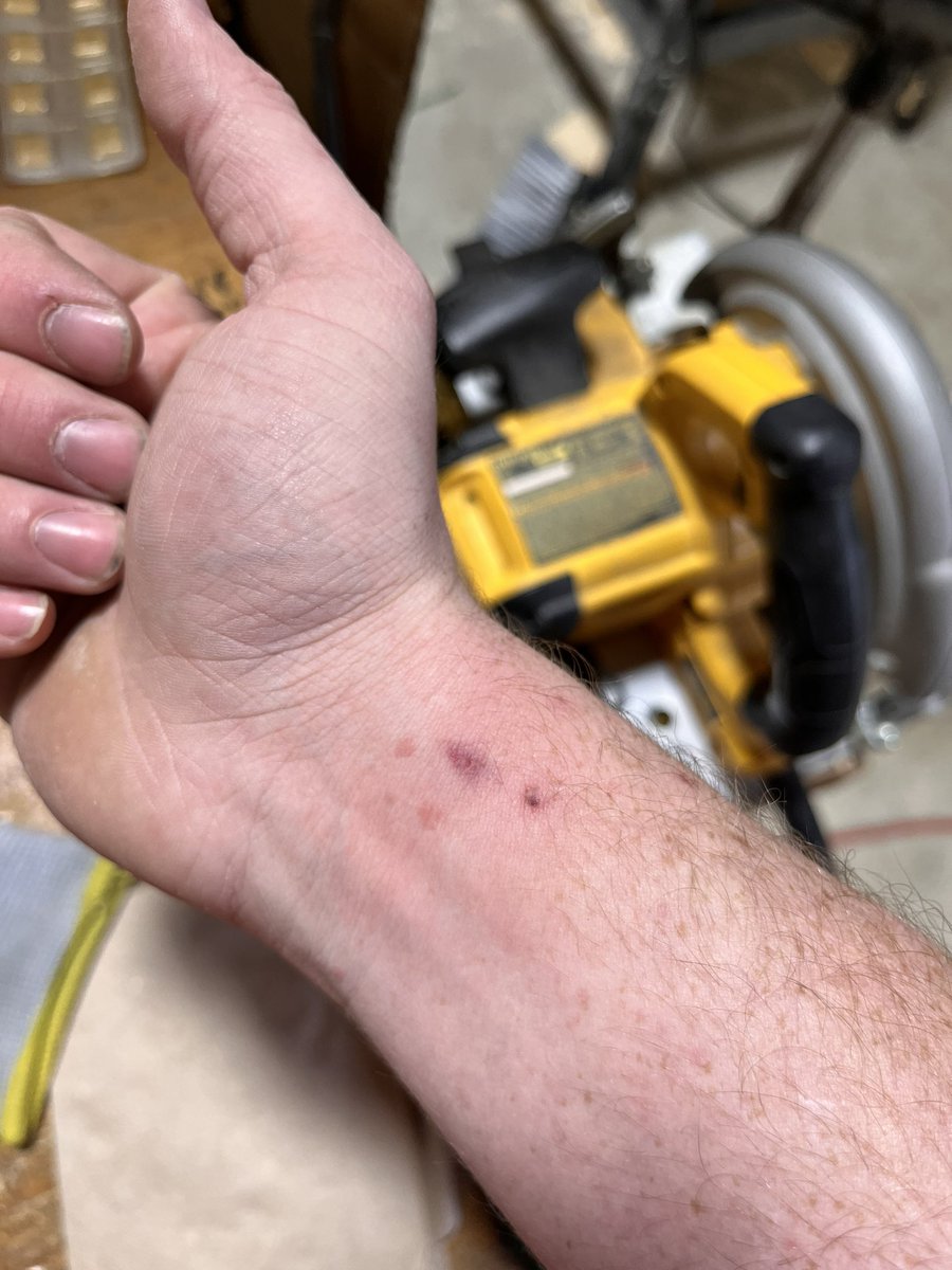 spencedelic's tweet photo. Second day straight a nail has ricocheted off my wrist https://t.co/0GFvNGcXzp