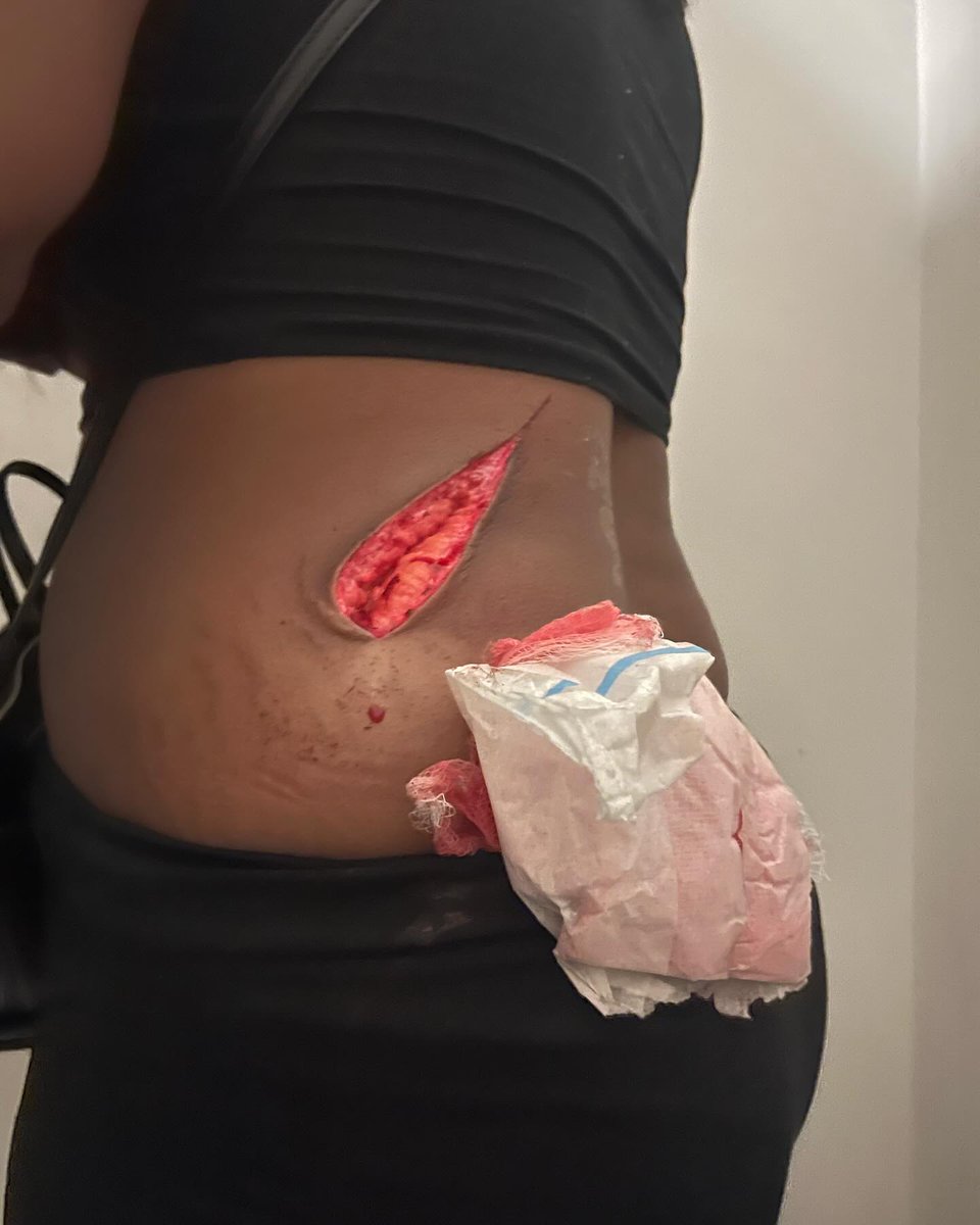Veetra__'s tweet photo. Two young women were left with horrific injuries after a Bolt driver allegedly stabbed them with a knife in Cape Town 💔 https://t.co/B3YKIoKUD9