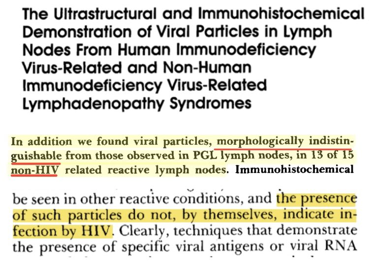 Particles identified as HIV are observed in tissue of AIDS patients. However, identical particles are also observed with the same frequency in tissue of patients who do not have AIDS and are not at risk of AIDS. pubmed.ncbi.nlm.nih.gov/3371979/