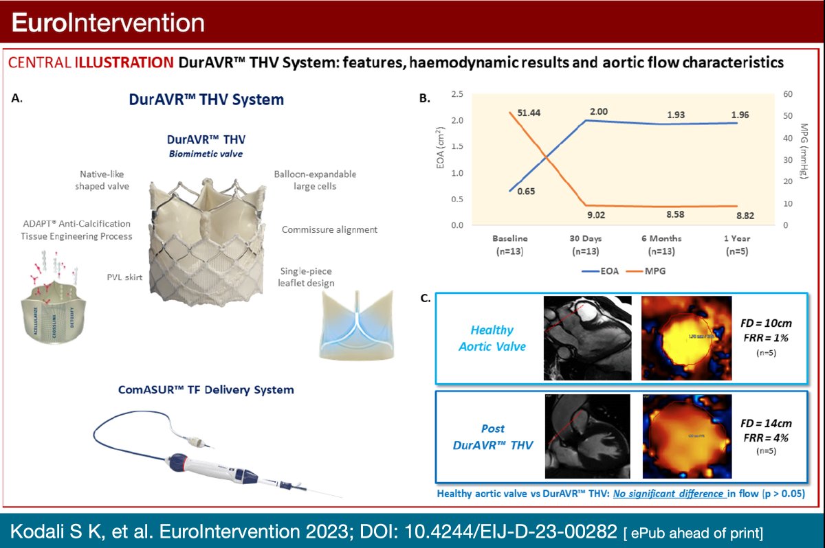 The DurAVR transcatheter heart valve was evaluated in a first-in-human study for treating symptomatic severe aortic stenosis. The study demonstrated a good safety profile and promising haemodynamic performance sustained at 1 year. #EIJBestOf ow.ly/L5PA50RzCBm