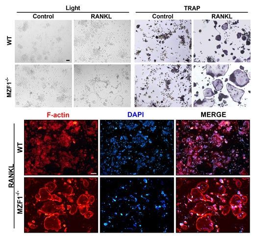 Take a look at this article by Qu and others in the May issue of #JLB! MZF1 knockdown promotes multinucleated osteoclast formation and differentiation. buff.ly/3Wx9c2F