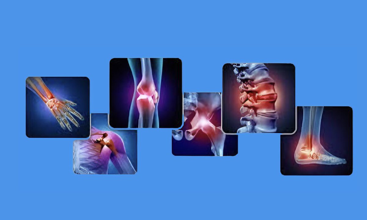 tinyurl.com/2kkwbe9n En artritis reumatoide, la combinación de acupuntura + fármacos es la clave para una menor inflamación, rigidez y dolor, superando a los fármacos solos. #ArtritisReumatoide #Acupunturamedica #TheUmbrellaCollaboration