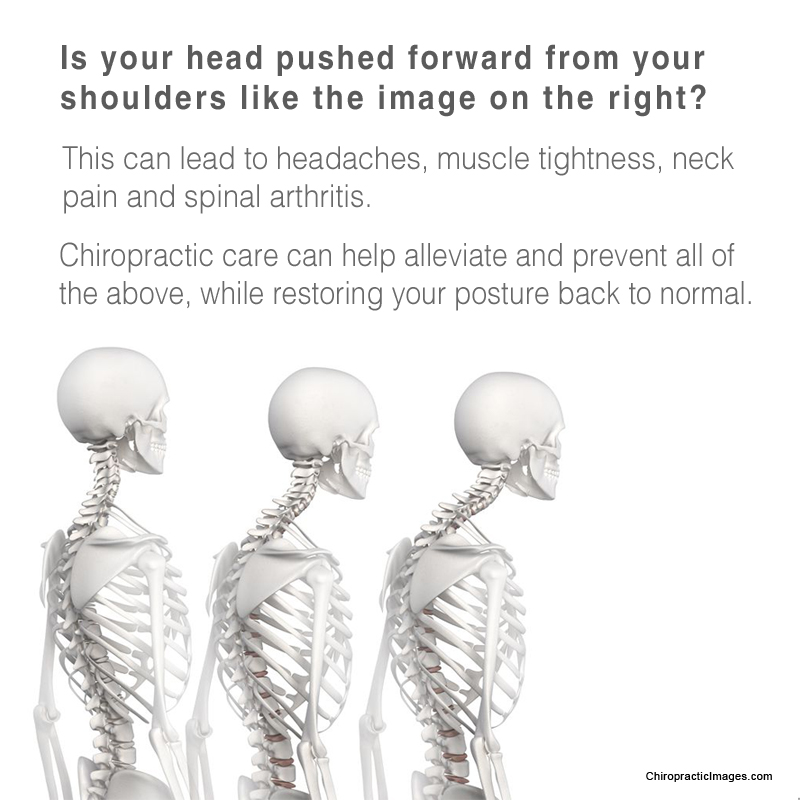 #Chiropractic #Chiropractor #Spine #SpineHealth #Posture #GetAdjusted