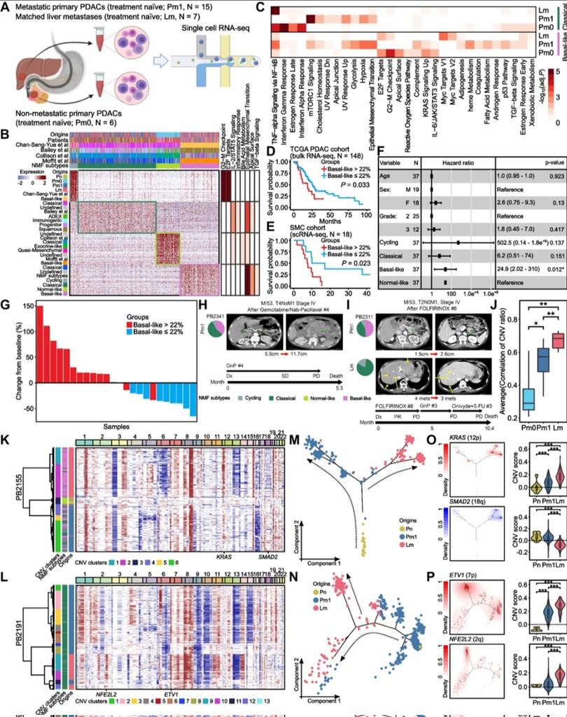 Park et al. used scRNA-seq to understand the interplay between intratumoral heterogeneity (ITH) and tumor microenvironment (TME) in the pancreatic ductal adenocarcinoma (PDAC) evolution and its clinical associations. ➡ molecular-cancer.biomedcentral.com/articles/10.11…

#singlecell #spatialomics