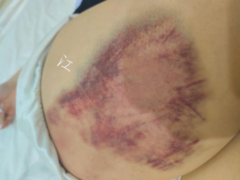 生日  更一下上次惨惨的小PP