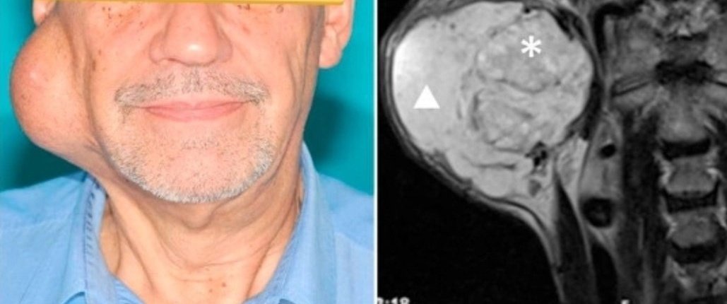 What is the diagnosis?