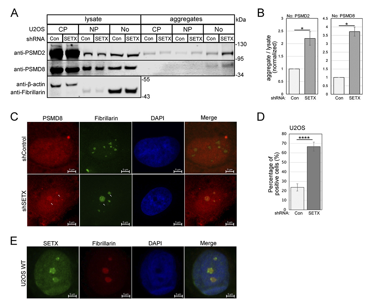 Wen, Paull et al. @ut_mbs show that loss of the RNA/DNA helicase Senataxin in human cells results in aggregation of cellular proteins and proteotoxic stress. hubs.la/Q02wxw_M0 #DNABiology #ProteinHomeostasis
