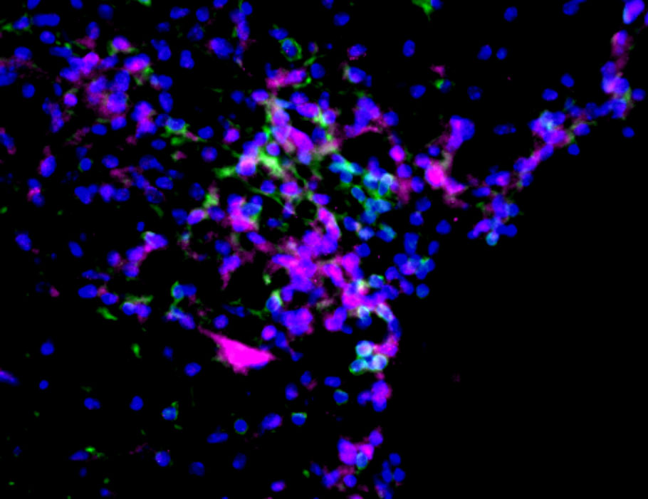 A mouse study by @CWRUSOM scientists identifies a potential therapeutic target to combat steroid resistance in #autoimmune #neuroinflammatory diseases such as #MultipleSclerosis. Read more: scim.ag/6SU