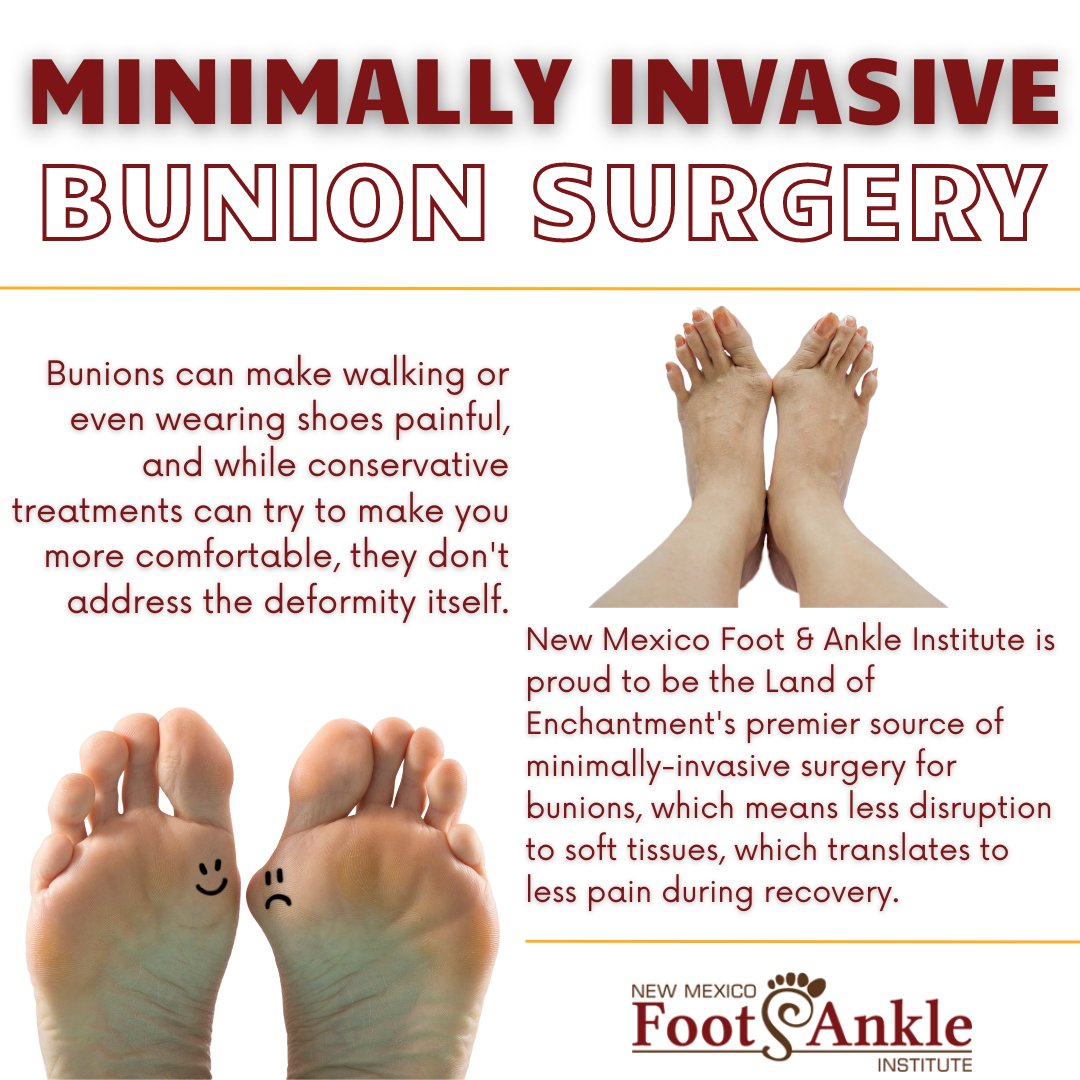 Is a bunion making your life miserable? Our podiatrists can help you determine if this procedure is right for you.
.
.
.
#bunions #bunionpain #bunionsurgery #footpain #anklepain #podiatry #bestpodiatrists #footdoc #photo #footsurgery #podiatrist #NewMexicoFootAndAnkleInstitute