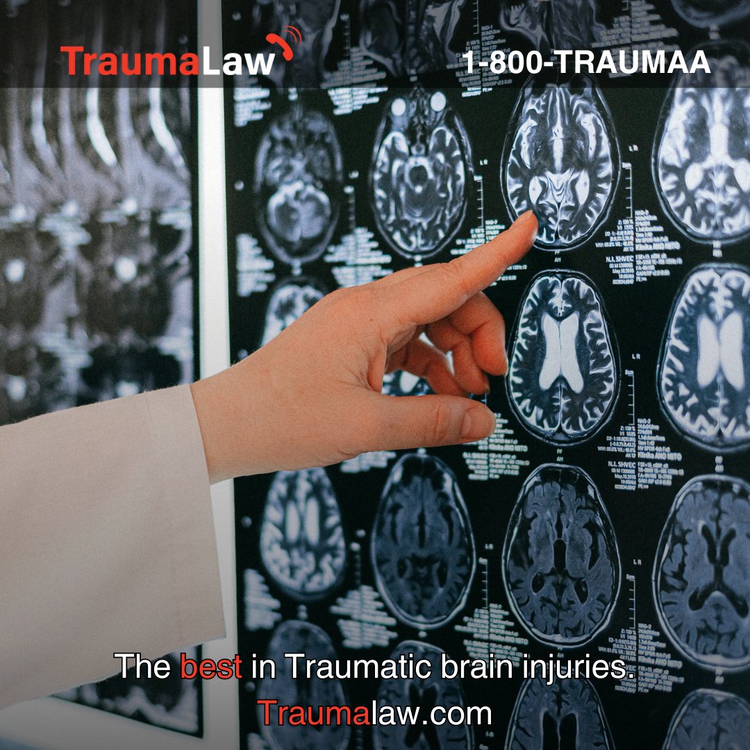 Trauma law, your Traumatic Brain Injury specialists.

#personalinjuryattorney #piattorney #injuryattorney