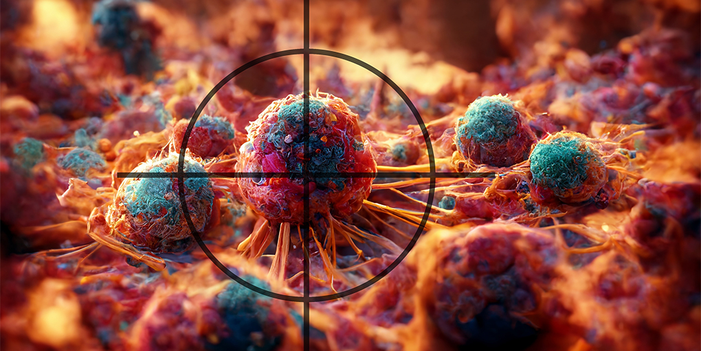 Cancer Discovery (@cd_aacr) on Twitter photo Lineage Differentiation Underlies #Glioma Response to IDH Inhibition, a summary of the study by <a href="/AvishaySpitzer/">Avishay Spitzer, MD, PhD 🎗️🧡</a>, <a href="/GritschSimon/">Simon Gritsch</a>, <a href="/M_Nomura/">Masashi Nomura</a>, <a href="/KeithLigon5/">Keith Ligon</a>, D. Cahill, <a href="/MarioSuva/">Mario Suva</a>, <a href="/TiroshLab/">Tirosh Lab</a> et al.
bit.ly/3UBnXii
<a href="/WeizmannScience/">Weizmann Institute</a> <a href="/MGHCancerCenter/">Mass General Cancer Center</a> <a href="/DanaFarber/">Dana-Farber</a> <a href="/broadinstitute/">Broad Institute</a> Lineage Differentiation Underlies #Glioma Response to IDH Inhibition, a summary of the study by <a href="/AvishaySpitzer/">Avishay Spitzer, MD, PhD 🎗️🧡</a>, <a href="/GritschSimon/">Simon Gritsch</a>, <a href="/M_Nomura/">Masashi Nomura</a>, <a href="/KeithLigon5/">Keith Ligon</a>, D. Cahill, <a href="/MarioSuva/">Mario Suva</a>, <a href="/TiroshLab/">Tirosh Lab</a> et al.
bit.ly/3UBnXii
<a href="/WeizmannScience/">Weizmann Institute</a> <a href="/MGHCancerCenter/">Mass General Cancer Center</a> <a href="/DanaFarber/">Dana-Farber</a> <a href="/broadinstitute/">Broad Institute</a>
