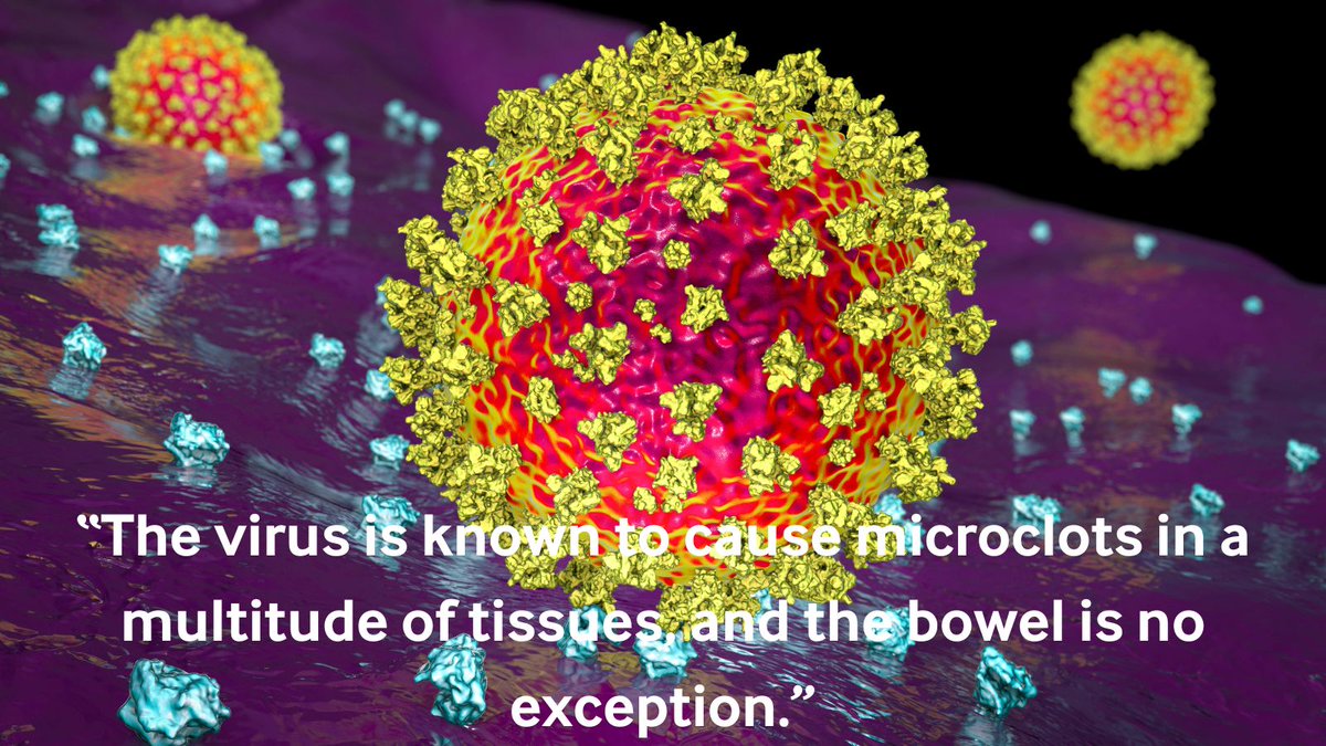 Gastrointestinal symptoms are common in both acute and long covid, with gut issues often persisting long after initial infection. What do we know about covid-19’s effects on the gut? 🔗 bit.ly/3QyoVL9