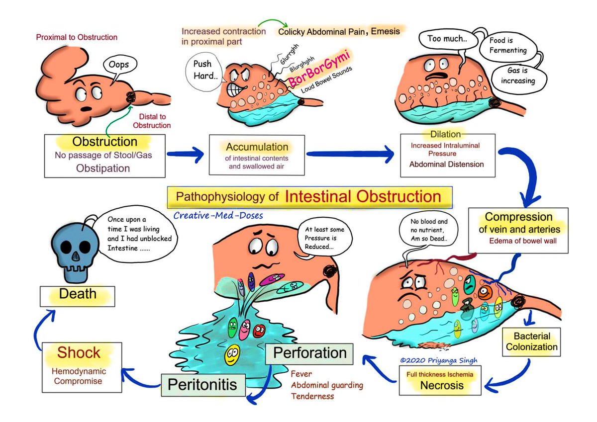 Pathophysiology of Bowel Obstruction ☠️
#MedEd #GITwitter